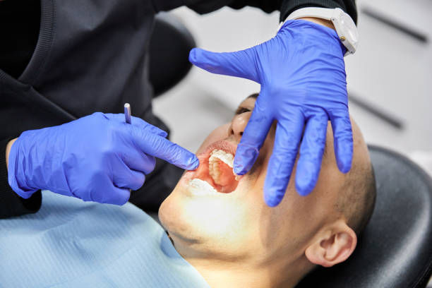 Best Emergency Wisdom Teeth Removal in Lake Mills, WI
