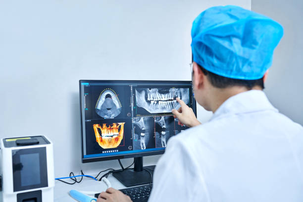 Best Emergency Root Canal Treatment in Lake Mills, WI